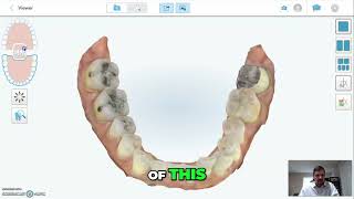 Achieving a Perfect Bite The Key to Resolving Dental Issues [upl. by Boehmer811]