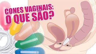 Cone Vaginal para que servem Ajudam na diástase Especialistas explicam [upl. by Nnylatsyrk]