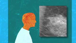 What is 3D Mammography [upl. by Fawcett]