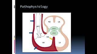 Cardiac Embryology The Key to Understanding Heart Development [upl. by Ellette]