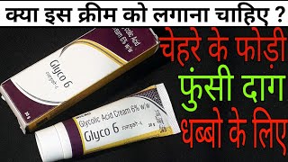 Glyco 6 Cream Review Hindi [upl. by Odraude]