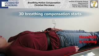 Breathing Motion Compensation [upl. by Ran]