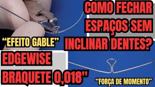 Como fechar espaços de exodontias sem inclinar dentes no aparelho Edgewie Braquete 0018  Aula 202 [upl. by Tyoh]