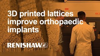 3D printed lattices improve orthopaedic implants [upl. by Girardi26]