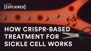 New CRISPRbased sickle cell treatment explained [upl. by Cole]