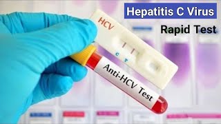 Hepatitis C Rapid Test  কিভাবে হেপাটাইটিসসি ভাইরাস পরীক্ষা করা হয়  AntiHCV RDT Test [upl. by Bubb]