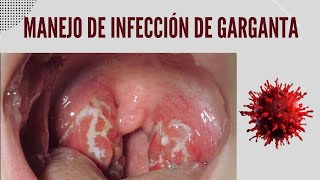 Manejo de la Infección y dolor de garganta [upl. by Ardnuasac]