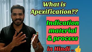 Apexification  Indication material and process of apexification [upl. by Oraneg]