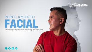 Testimonio  Cirugía de Perfilamiento facial Aumento de mentón y paranasal [upl. by Anoniw]