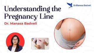 Linea Nigra All You Need to Know About the Pregnancy Line  Dr Manasa Badveli [upl. by Kcirdnekel]