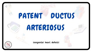 PATENT DUCTUS ARTERIOSUS  Causes  Symptoms  Pathophysiology  Treatment  The Nurses Station [upl. by Bannasch113]