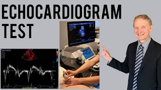 Echocardiogram Procedure  Heart Ultrasound  Everything you need to know [upl. by Gittel]