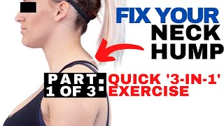 QUICK Fix for Neck Hump  Dowagers Hump Fix  How to Get Rid of a Neck Hump [upl. by Toy572]