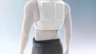 LifeVest Patient Education Video Chapter 3 Wearing the LifeVest [upl. by Assirroc216]