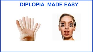 DIPLOPIA MADE EASY [upl. by Aimac]