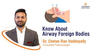 Know About Airway Foreign Bodies  Yashoda Hospitals Hyderabad [upl. by Andaira]