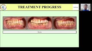 Geriadent 2024 Paper Presentation [upl. by Oderf]