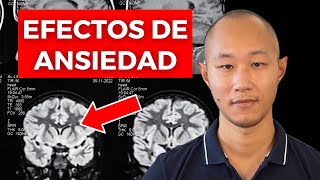 13 Señales de ANSIEDAD MÁS COMUNES del MUNDO Síntomas De La Ansiedad Explicados [upl. by Yerffeg]