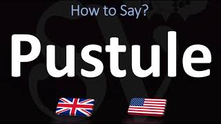 How to Pronounce Pustule CORRECTLY [upl. by Accebber380]