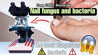 Nail mass under the microscope  Bacteria and parasites [upl. by Skipp947]