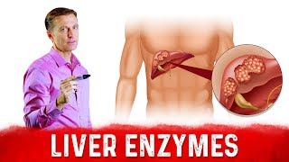 High Liver Enzymes ALT amp AST – What Do They Mean – DrBerg [upl. by Nyrrat493]