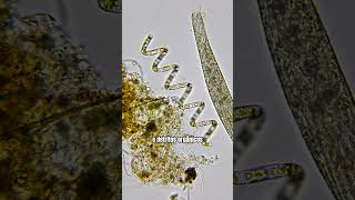 Protozoário gigante passa por dentro de microalga espiralada microorganismos microbiologia [upl. by Mailiw]