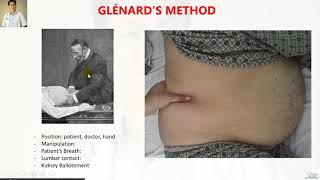 Kidney examination with Glenard and Israel method [upl. by Abrahamsen137]