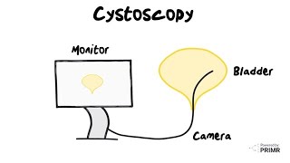 What is a Cystoscopy [upl. by Eniamsaj]