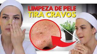 😃 limpeza de pele profunda com extração de cravos e espinhas  cravos e espinhas 😃😉 [upl. by Clapper962]