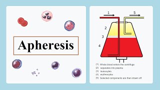 apheresis [upl. by Swane]