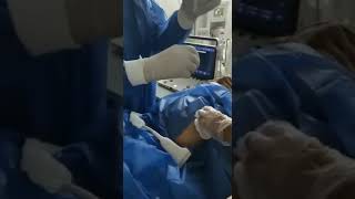 Ultrasound guided omental biopsy Dr El Sayed Imam [upl. by Yvor]