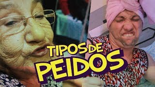 TIPOS DE PEIDO 1 [upl. by Kantos12]