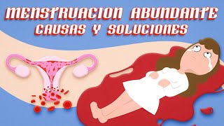 MENSTRUACION ABUNDANTE ¡CAUSAS y SOLUCIÓN por Ginecologa Diana Alvarez [upl. by Notyal]