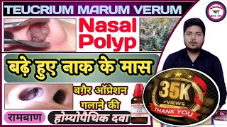 NASAL POLYP Treatment  Teucrium Marum Verum  नाक के मास को गलाने की अचूक दवा  Ascarides Worms [upl. by Melonie]