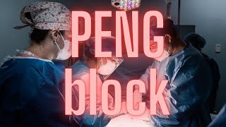 Podcast PENG Block  Pericapsular Nerve Group Block  2024 [upl. by Ihtac]