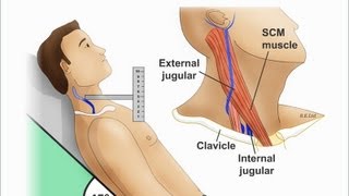 Jugular Venous Distention Explained clearly PART A Jugular venous pressure Waveform [upl. by Anrev]