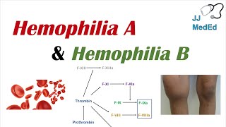 Hemophilia A vs Hemophilia B  Genetics Symptoms and Treatment [upl. by Nosreh]