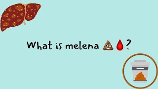 What is melena  upper gi bleeding [upl. by Dylane]