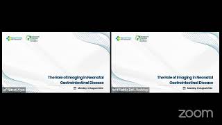 Webinar The Role of Imaging of Gastrointestinal disease in Neonatal [upl. by Tarsus865]