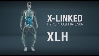 Xlinked hypophosphatemia XLH mechanism of disease [upl. by Behre]