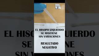 Técnicas Forenses ¿Esa mancha es de sangre humana o no criminalística forensic jpacriminalista [upl. by Lasorella]