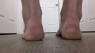 Do you have flat feet Part 2 [upl. by Eldreda]