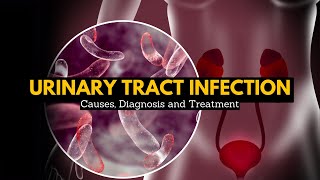 Urinary Tract Infection Causes Signs and Symptoms Diagnosis and Treatment [upl. by Trilbi738]