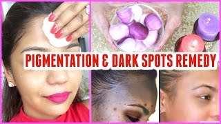 Skin Whitening Natural remedy Dark Spots amp Pigmentation Treatment  SuperPrincessjo [upl. by Ettennig]