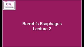 Lecture 2 Barretts Oesophagus [upl. by Dacia597]