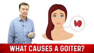 What Causes a Goiter Causes of Thyroid Enlargement – DrBerg [upl. by Berg]