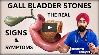 Gall Bladder Stones  लक्षण  The Real Signs amp Symptoms  DrEducation Eng Hindi [upl. by Notlehs586]