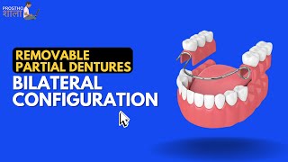 BILATERAL CONFIGURATION IN REMOVABLE PARTIAL DENTURES [upl. by Zertnom]