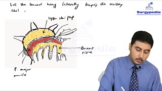 Steps of Modified Radical Mastectomy [upl. by Nodmac]