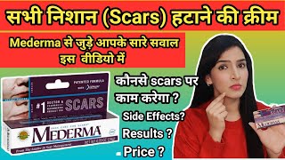 Mederma cream  Mederma for Acne scars  Mederma advanced scar gel review  Q amp A on Mederma [upl. by Erund]